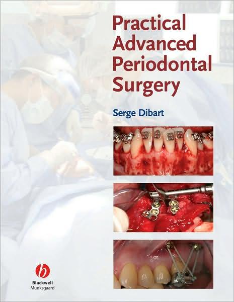 Practical Advanced Periodontal Surgery                                                                                                                <br><span class="capt-avtor"> By:                                                  </span><br><span class="capt-pari"> Eur:39,01 Мкд:2399</span>